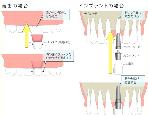 gishi-zukai.gif